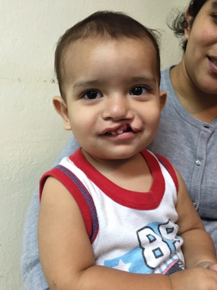 His mother had just returned from El Salvador, where she was attempting to have is lip repaired